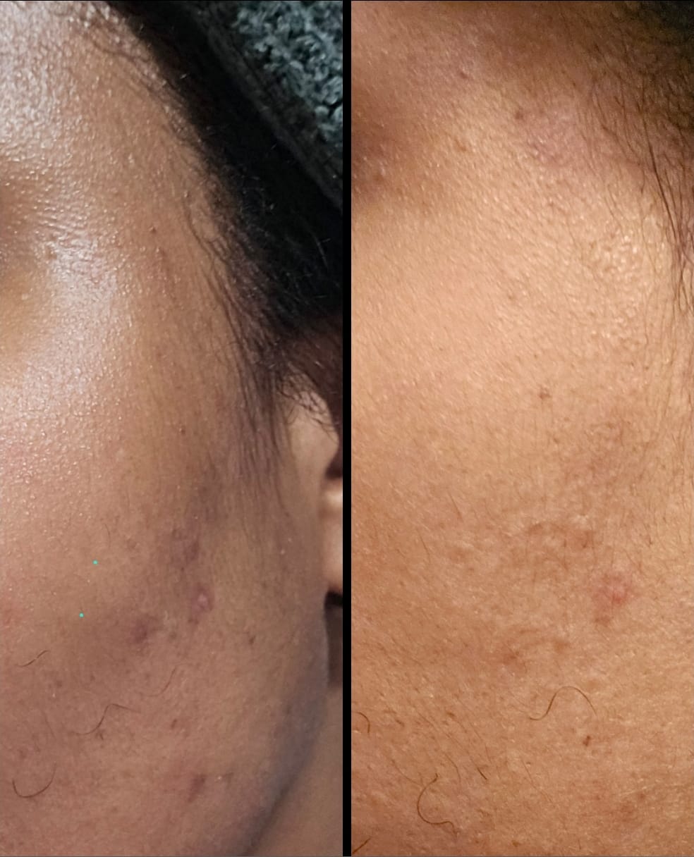 Crème pour le visage