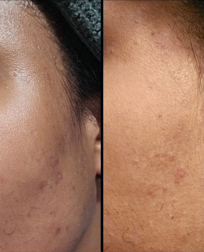 Crème pour le visage